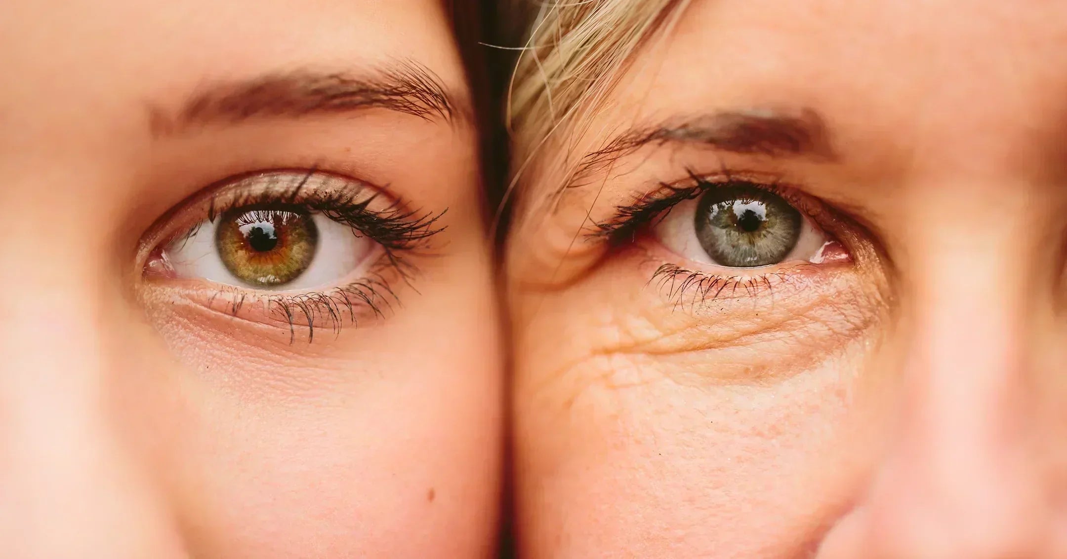 Signs you have a collagen deficiency