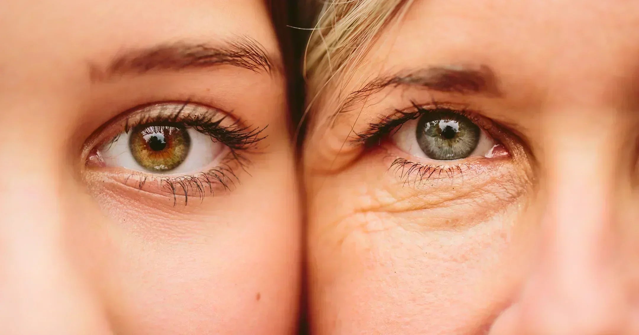 12 signs of collagen deficiency: Symptoms, causes and how to restore it naturally