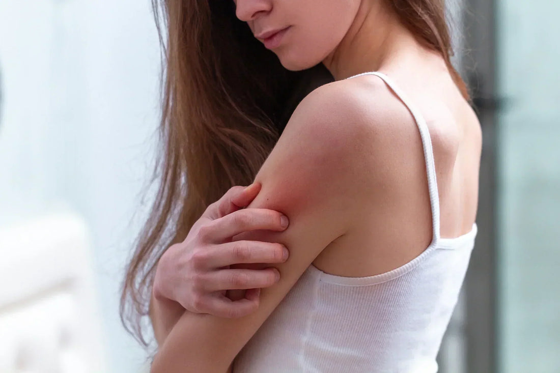 What is the best natural eczema treatment?